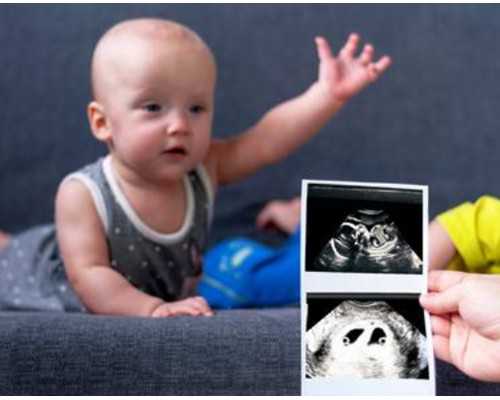 南京医院怎么借卵,做试管婴儿到底痛不痛苦_在上海找供卵去哪里-南京公立医院